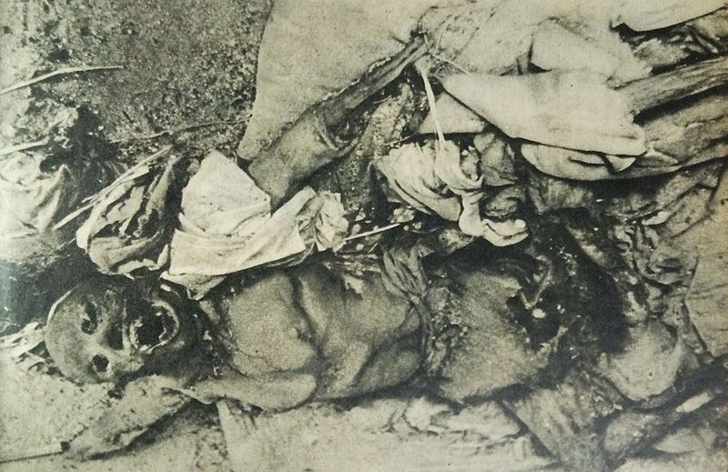 A_victim_of_the_atomic_attack_on_Nagasaki